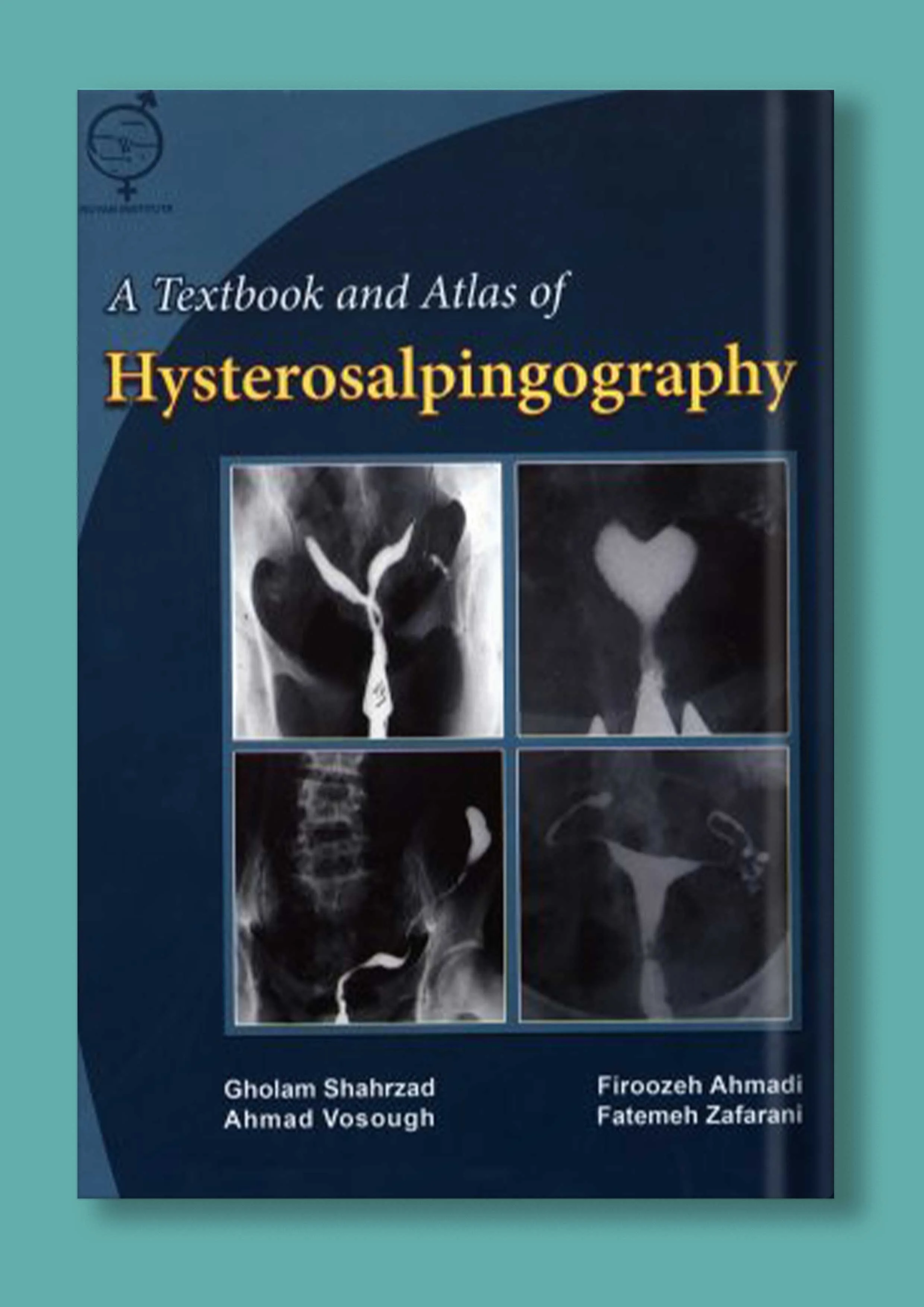 A Textbook and Atlas of 2D/3D Hysterosonography